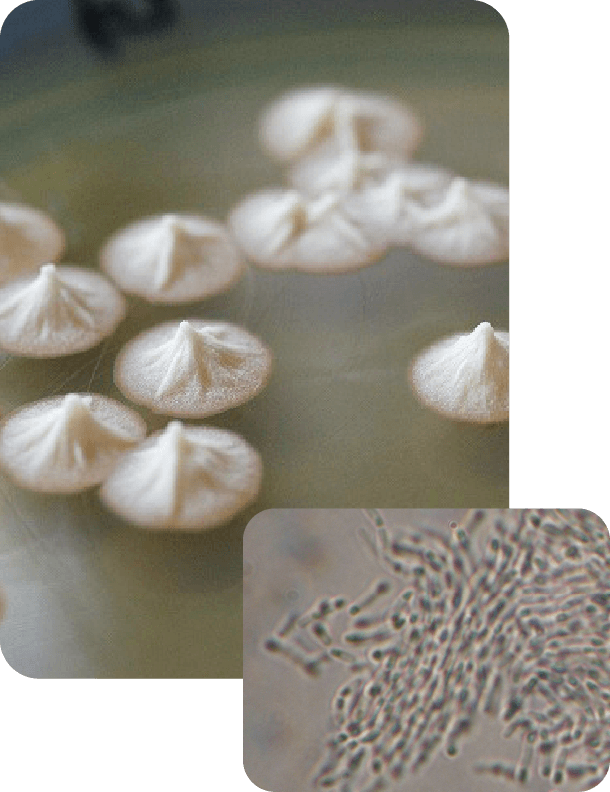 納豆菌SONOMONO株 Bacillus subtilis var. natto SONOMONO, 写真