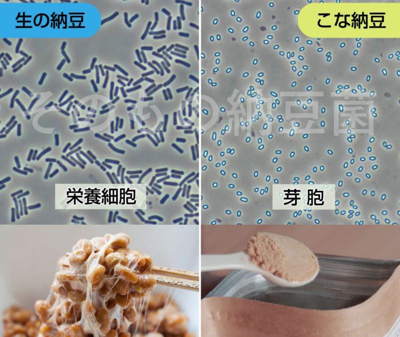 位相差顕微鏡で見た納豆菌の芽胞と栄養細胞の比較